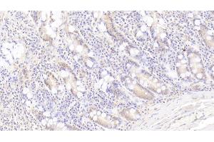 Detection of PLA2G4 in Human Small intestine Tissue using Polyclonal Antibody to Cytosolic Phospholipase A2 (PLA2G4) (PLA2G4A Antikörper  (AA 1-178))