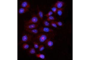 IF analysis of FBP1 using anti-FBP1 antibody (ABIN7599395). (FBP1 Antikörper  (AA 1-44))