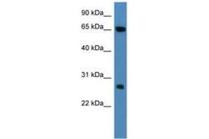 Image no. 1 for anti-Kelch Repeat and BTB (POZ) Domain Containing 8 (KBTBD8) (AA 63-112) antibody (ABIN6746791) (KBTBD8 Antikörper  (AA 63-112))