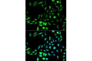Immunofluorescence analysis of MCF-7 cells using KPNA2 antibody. (KPNA2 Antikörper  (AA 1-290))