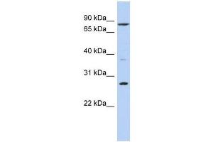Western Blot showing KLF12 antibody used at a concentration of 1-2 ug/ml to detect its target protein. (KLF12 Antikörper  (N-Term))