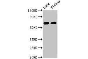 Western Blot Positive WB detected in: Rat lung tissue, Mouse kidney tissue All lanes: IQCB1 antibody at 3. (IQCB1 Antikörper  (AA 445-598))