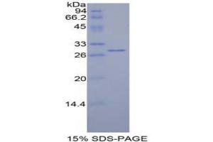SDS-PAGE analysis of Mouse Mindbomb Homolog 2 Protein. (MIB2 Protein)