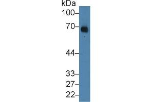 Detection of ALB in Human Serum using Polyclonal Antibody to Albumin (ALB) (Albumin Antikörper)