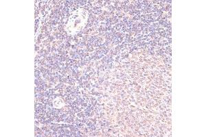 Immunohistochemistry of paraffin-embedded rat spleen using HSF1 antibody (ABIN6131141, ABIN6142021, ABIN6142022 and ABIN6217875) at dilution of 1:100 (40x lens). (HSF1 Antikörper  (AA 350-529))