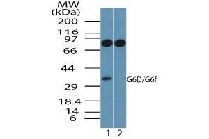 Image no. 1 for anti-Lymphocyte Antigen 6 Complex, Locus G6F (LY6G6F) (AA 50-100) antibody (ABIN960257) (LY6G6F Antikörper  (AA 50-100))
