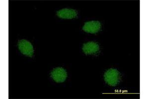 Immunofluorescence of purified MaxPab antibody to FOXI1 on HeLa cell.