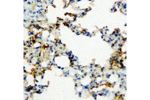 Anti-RAGE antibody, IHC(P) IHC(P): Rat Lung Tissue (RAGE Antikörper  (Middle Region))