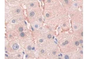 DAB staining on IHC-P; Samples: Human Liver Tissue (SFRP4 Antikörper  (AA 25-222))