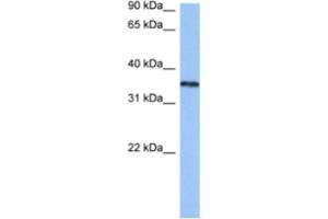 Western Blotting (WB) image for anti-Heterogeneous Nuclear Ribonucleoprotein A2/B1 (HNRNPA2B1) antibody (ABIN2462310) (HNRNPA2B1 Antikörper)