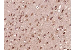 Paraformaldehyde-fixed, paraffin embedded Rat brain Antigen retrieval by boiling in sodium citrate buffer (pH6. (MEK1 Antikörper  (pThr286))