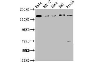Western Blot Positive WB detected in: Hela whole cell lysate, MCF-7 whole cell lysate, K562 whole cell lysate, U87 whole cell lysate, Rat brain tissue All lanes: RAD54L2 antibody at 3. (ARIP4 Antikörper  (AA 1122-1296))