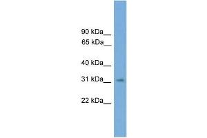 Human 721_B; WB Suggested Anti-SPRY3 Antibody Titration: 0. (SPRY3 Antikörper  (N-Term))