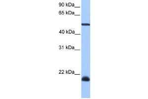 Western Blotting (WB) image for anti-Dyslexia Susceptibility 1 Candidate 1 (DYX1C1) antibody (ABIN2459540) (DYX1C1 Antikörper)