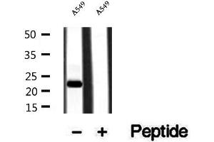 Western blot analysis of extracts of A549 cells, using PPPDE1/PNAS4 antibody. (PPPDE1 Antikörper  (Internal Region))
