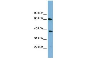 WB Suggested Anti-GNL3 Antibody Titration: 0.