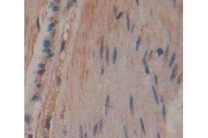 IHC-P analysis of Human Tissue, with DAB staining. (CCDC80 Antikörper  (AA 81-258))