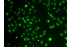 Immunofluorescence analysis of MCF-7 cells using POU6F1 antibody (ABIN5974401). (POU6F1 Antikörper)