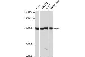 Western blot analysis of extracts of various cell lines, using eEF2 Rabbit mAb (ABIN7267025) at 1:1000 dilution. (EEF2 Antikörper)