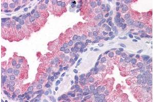 Human Prostate: Formalin-Fixed, Paraffin-Embedded (FFPE) (TMEM184A Antikörper  (C-Term))