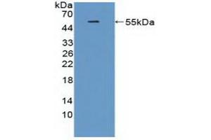 Detection of Recombinant TREM2, Rat using Polyclonal Antibody to Triggering Receptor Expressed On Myeloid Cells 2 (TREM2)