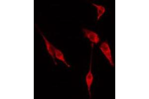 ABIN6274614 staining Hela cells by IF/ICC. (CDC20 Antikörper  (N-Term))