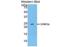 Western Blotting (WB) image for anti-Linker For Activation of T Cells Family, Member 2 (LAT2) (AA 30-209) antibody (ABIN3202070) (LAT2 Antikörper  (AA 30-209))
