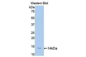 Western Blotting (WB) image for anti-Slit Homolog 1 (SLIT1) (AA 3-112) antibody (ABIN1176122) (SLIT1 Antikörper  (AA 3-112))