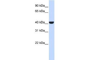 WB Suggested Anti-ERLIN2 Antibody Titration: 0. (ERLIN2 Antikörper  (Middle Region))