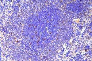 IHC analysis of SCN11A using anti-SCN11A antibody (ABIN7603132).