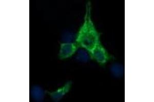 Image no. 4 for anti-Synaptophysin (SYP) antibody (ABIN1501256) (Synaptophysin Antikörper)