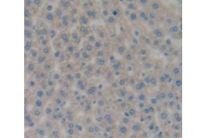 IHC-P analysis of Rat Tissue, with DAB staining. (CD11b Antikörper  (AA 598-700))
