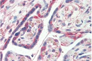 ABIN185153 (5µg/ml) staining of paraffin embedded Human Placenta. (PDLIM1 Antikörper  (C-Term))