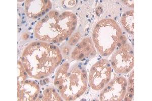 Used in DAB staining on fromalin fixed paraffin- embedded Kidney tissue (NCK1 Antikörper  (AA 2-377))