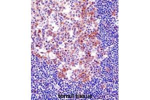 Immunohistochemistry (IHC) image for anti-Spleen Focus Forming Virus (SFFV) Proviral Integration Oncogene Spi1 (SPI1) antibody (ABIN2998289) (SPI1 Antikörper)
