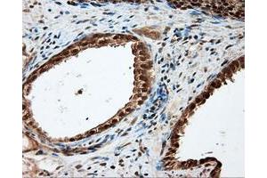 Immunohistochemical staining of paraffin-embedded liver tissue using anti-LIPG mouse monoclonal antibody. (LIPG Antikörper)