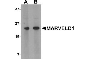 Western blot analysis of MARVELD1 in mouse heart tissue lysate with MARVELD1 antibody at (A) 1 and (B) 2 µg/mL.