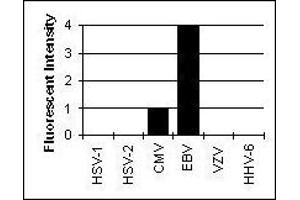 Cross Reactivity Results determined by IFA (EBV-Gp350 Antikörper)