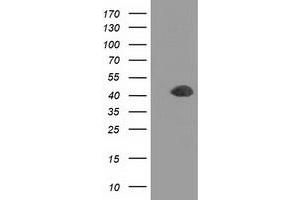 Western Blotting (WB) image for anti-Doublecortin (DCX) antibody (ABIN1497783) (Doublecortin Antikörper)