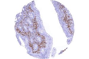 In the appendix CD38 staining occurs in various inflammatory cells while the epithelial cells remain CD38 negative