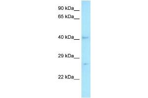 WB Suggested Anti-MED7 Antibody   Titration: 1. (MED7 Antikörper  (C-Term))
