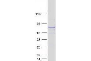 Validation with Western Blot