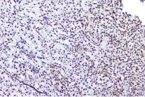 IHC analysis of TPR using anti-TPR antibody (ABIN5693275). (TPR Antikörper)
