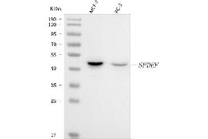 Western blot analysis of PSE/SPDEF using anti-PSE/SPDEF antibody (ABIN7601954).