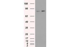 Western Blotting (WB) image for anti-Neurotrophic tyrosine Kinase, Receptor, Type 3 (NTRK3) antibody (ABIN1499843) (NTRK3 Antikörper)