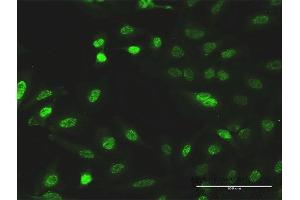 Immunofluorescence of monoclonal antibody to CITED1 on HeLa cell. (CITED1 Antikörper  (AA 1-193))