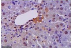 Representative immunohistochemistry of HM GB1 (brown) in liver during hepatitis. (HMGB1 Antikörper)