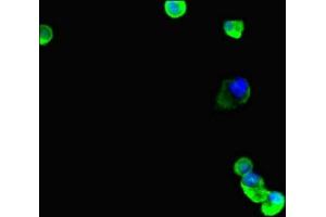 Immunofluorescent analysis of MCF-7 cells using ABIN7173691 at dilution of 1:100 and Alexa Fluor 488-congugated AffiniPure Goat Anti-Rabbit IgG(H+L) (TUBB4 Antikörper  (AA 1-444))