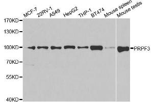 Western blot analysis of extracts of various cell lines, using PRPF3 antibody.