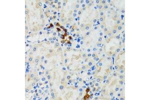 Immunohistochemistry (Paraffin-embedded Sections) (IHC (p)) image for anti-GABA(A) Receptor-Associated Protein (GABARAP) (AA 1-100) antibody (ABIN6140872)